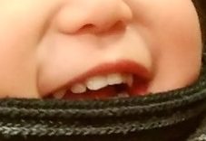綺麗な前歯
